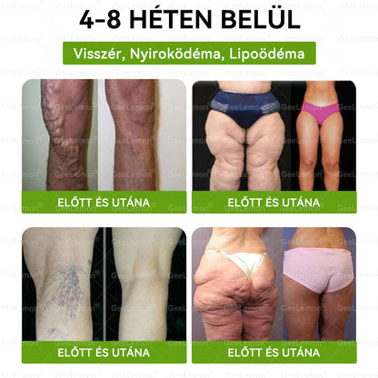 Ajánlott a Semmelweis Kórház által · 👩‍⚕️BENU hivatalos üzlet| 🎄✅ 𝐆𝐞𝑒𝐿𝑒𝐦𝐨𝐧® Glumasetide 8 az 1-ben Karcsú és Egészséges Nano Mikrotűs Tapasz 🇭🇺